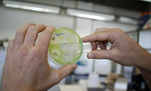 Cases of drug-resistant typhoid register spike in Karachi