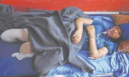 &lsquo;I want my legs back,&rsquo; says Gaza child amputee