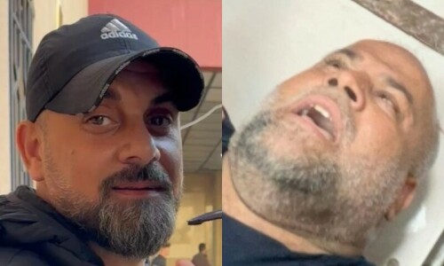 Al Jazeera cameraman killed, journalist injured in Gaza missile strike Al Jazeera cameraman killed, journalist injured in Gaza missile strike