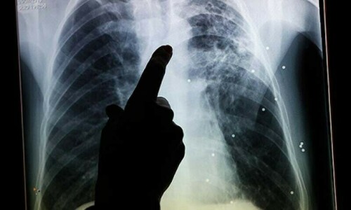 Pakistan sets new targets for treatment of tuberculosis Pakistan sets new targets for treatment of tuberculosis