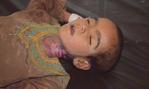 More than half the world faces high measles risk: WHO More than half the world faces high measles risk: WHO