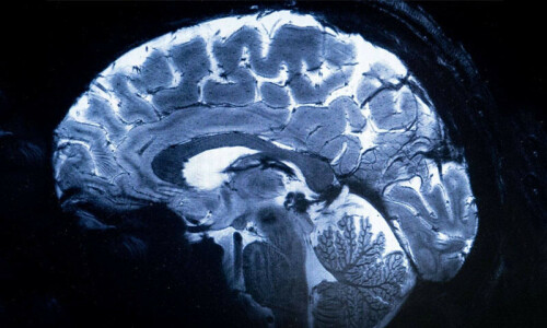 World&rsquo;s most powerful MRI scans first images of human brain