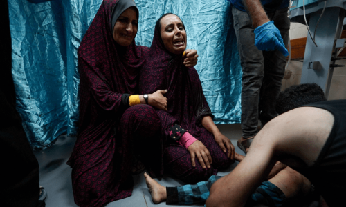 Doctor says Gaza hospitals operating in ‘mediaeval’ conditions Doctor says Gaza hospitals operating in ‘mediaeval’ conditions