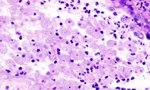 NIH issues advisory regarding Naegleria