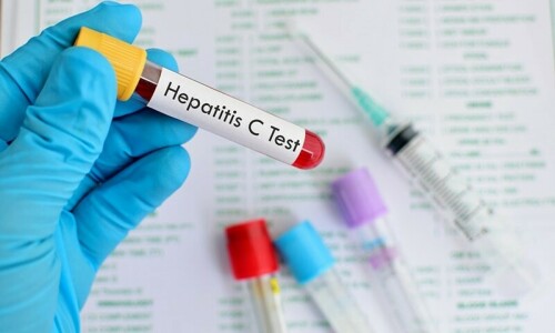 PM’s hepatitis C eradication programme to be launched this month PM’s hepatitis C eradication programme to be launched this month