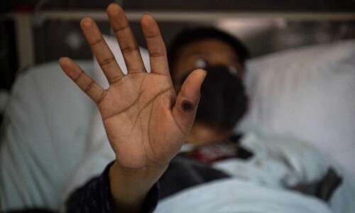 Explainer: Why is mpox an emergency again and how worried should you be? Explainer: Why is mpox an emergency again and how worried should you be?