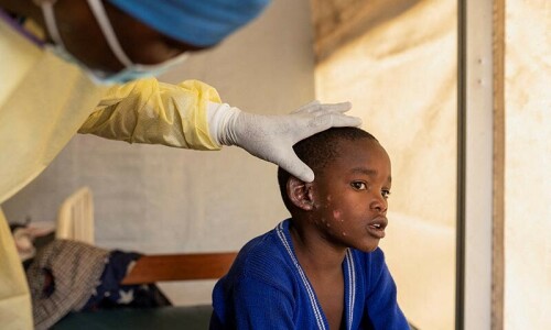 Mpox kills 548 in DR Congo this year