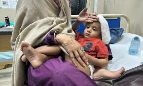 What mpox means for our children What mpox means for our children