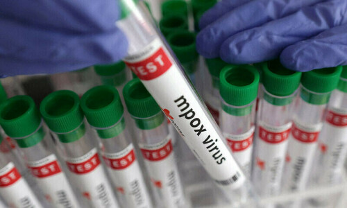 Two ‘mpox patients’ from abroad land in Karachi Two ‘mpox patients’ from abroad land in Karachi