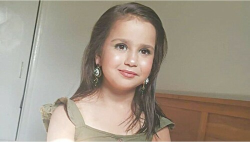 Sara Sharif murder trial highlights possible concealment of bruises Sara Sharif murder trial highlights possible concealment of bruises