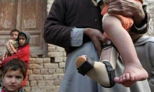 Third polio case of 2025 reported in Pakistan Third polio case of 2025 reported in Pakistan