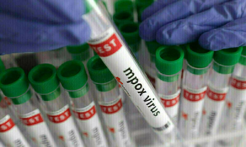 Sindh&rsquo;s second mpox case of the year detected
