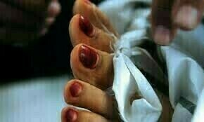 Mother of three tortured to death allegedly by husband in Rawalpindi