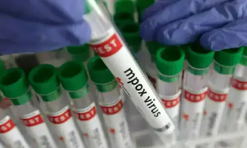 Alarm raised over outbreak of mpox in Khairpur