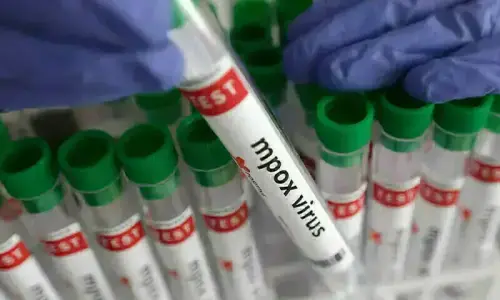 Young man tests positive for mpox in Karachi Young man tests positive for mpox in Karachi