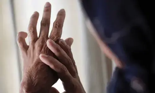 Acid attack victim Mahnoor to get treatment abroad Acid attack victim Mahnoor to get treatment abroad