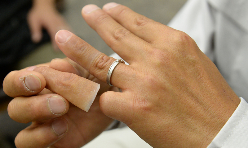 Fake Fingers Help Ex Japanese Mobster Lead Lawful Life World DAWN COM