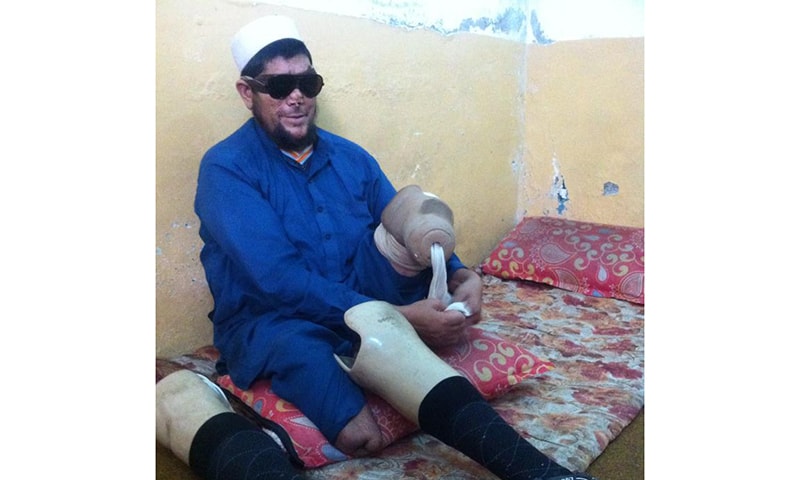 Bahadar attaches an artificial leg to his knee, recalling the incident that changed his life. —Photo by author