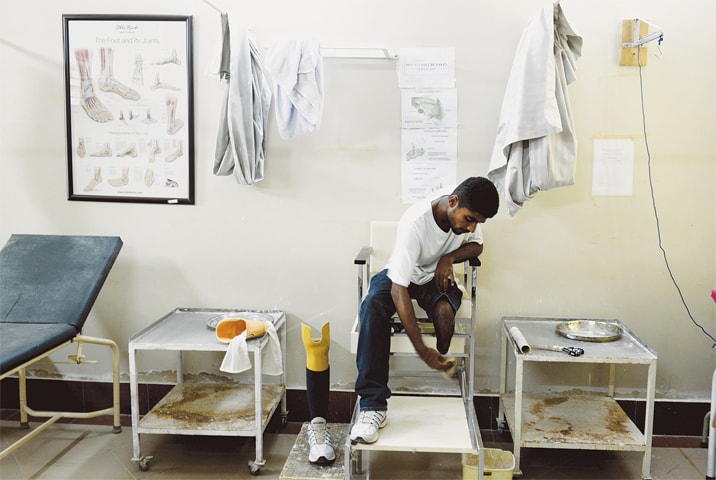 Getting an artificial limb made is a process that involves a patient, a doctor and an engineer. Some minor tweaks often need to be made before patients are sent home -Photos by Tahir Jamal / White Star