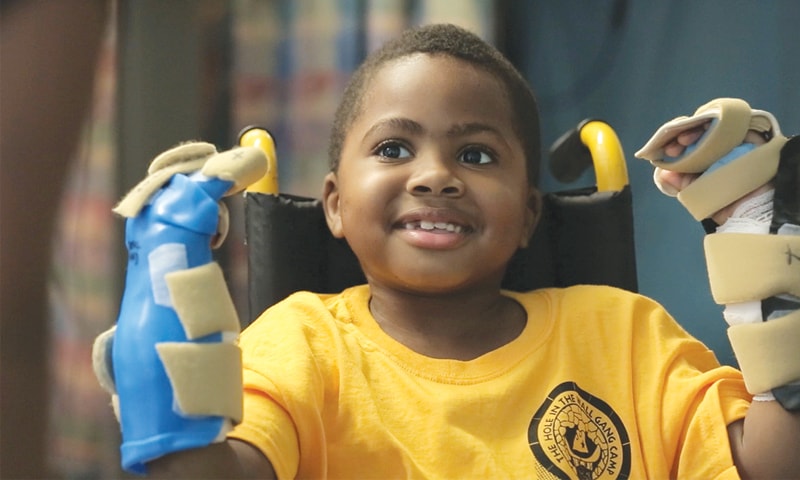 Zion Harvey seen with his newly transplanted hands.&mdash;AFP
