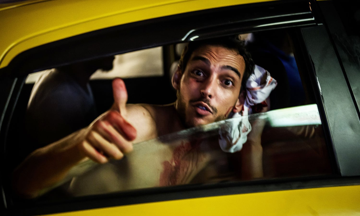 An injured man reacts as he goes to a hospital at Taksim square in Istanbul on July 16. — AFP