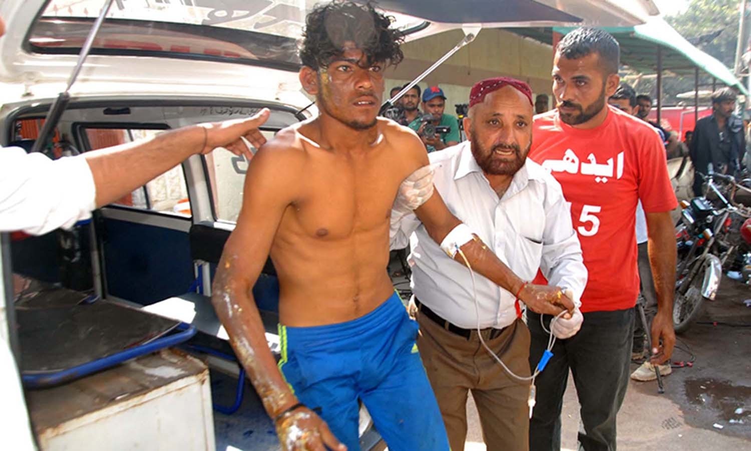 Rescue officials shift an injured worker to Civil Hospital Karachi. ─PPI