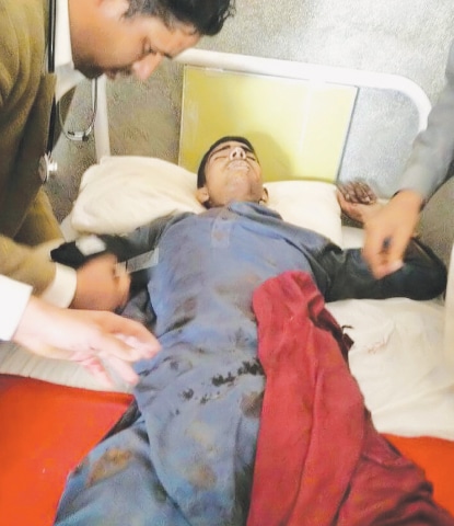 A boy is being treated in a hospital after he suffered wounds in unprovoked firing by Indian forces in the Bhimber sector.—Online