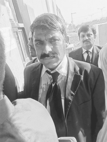 ISLAMABAD: An injured lawyer after the scuffle with police on the entrance of accountability court.—Online