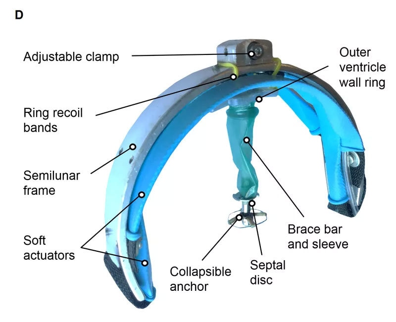 اس سافٹ روبوٹ کو وینٹریکل اسسٹ ڈیوائس کا نام دیا گیا ہے—فوٹو: دی ورج
