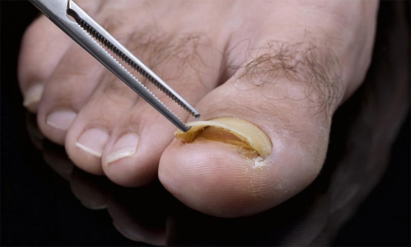 &mdash; شٹر اسٹاک فوٹو