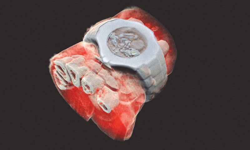 This handout picture, released by MARS Bioimaging, shows a 3D image of a wrist with 
a watch showing part of the finger bones in white and soft tissue in red.&mdash;AFP