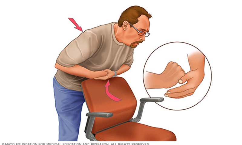 فوٹو بشکریہ مایو کلینک