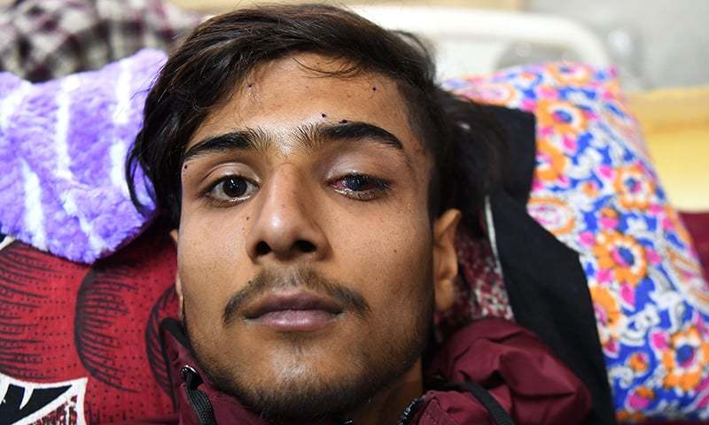 Oyeeb Ahmad, 14, resting on a bed in Srinagar's main hospital after his left eye was damaged by pellet gun fired by Indian government forces. — AFP