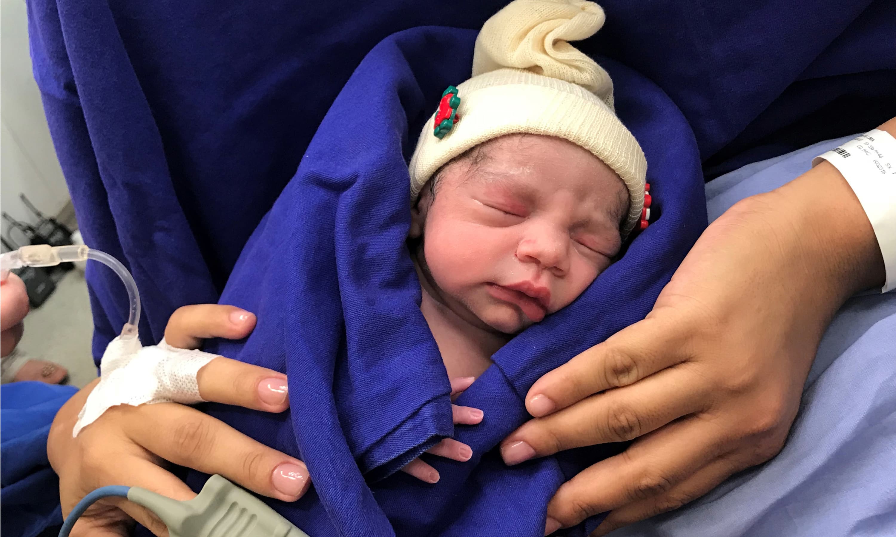 This Dec 15, 2017, photo provided by transplant surgeon Dr. Wellington Andraus shows the baby girl born to a woman with a uterus transplanted from a deceased donor at the Hospital das Clinicas of the University of Sao Paulo School of Medicine, Sao Paulo, Brazil, on the day of her birth. Nearly a year later, mother and baby are both healthy. &mdash;AP