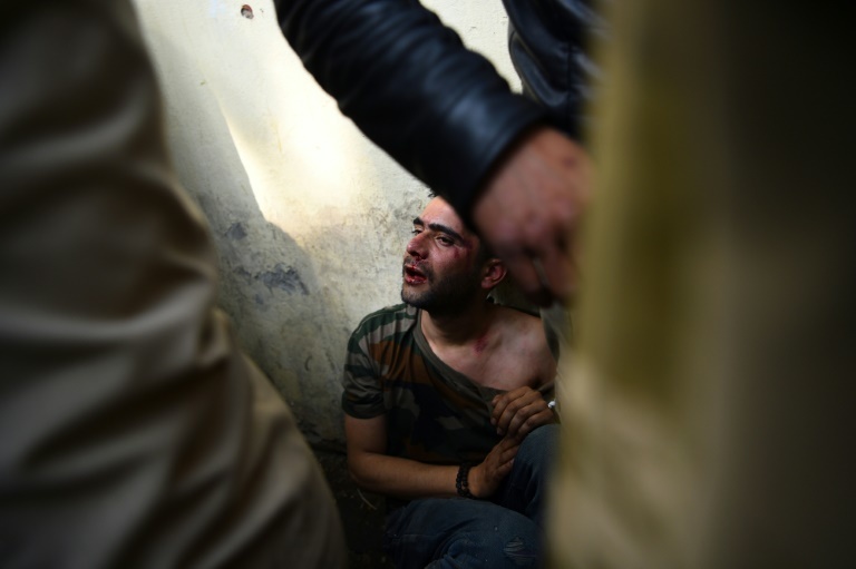 A Kashmiri man beaten by a mob in New Delhi that accused him of chanting anti-India slogans. — AFP