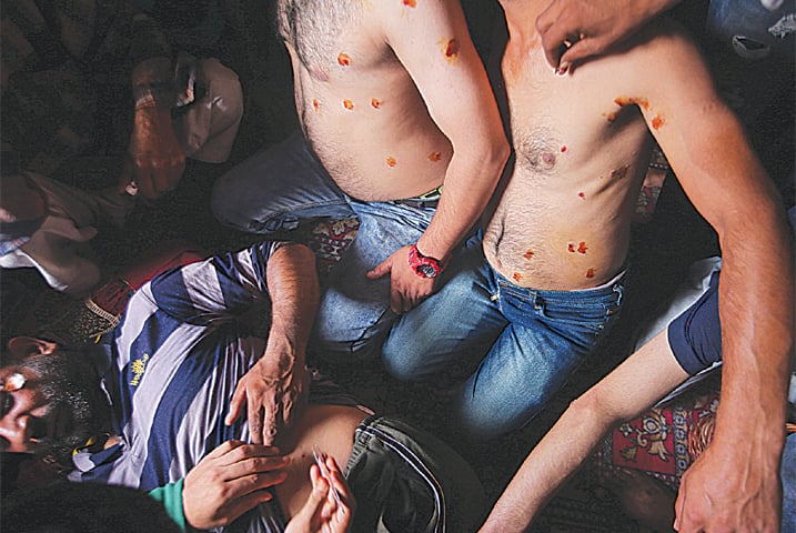 SRINAGAR: Men with pellet injuries are treated inside a house in a neighbourhood where there have been regular clashes with Indian forces.—Reuters