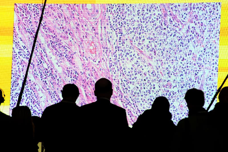 Cancer cells are seen on a large screen connected to a microscope at the CeBit computer fair in Hanover, Germany. &mdash; Reuters/File