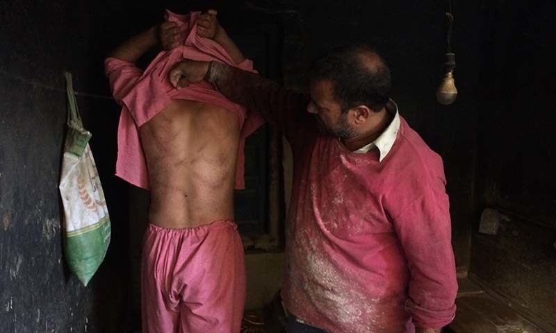 In this August 26 photo, a Kashmiri baker Sonaullah Sofi lifts the shirt from his son's back to show torture marks allegedly caused by Indian army soldiers at their bakery in southern village of Parigam in occupied Kashmir. — AP