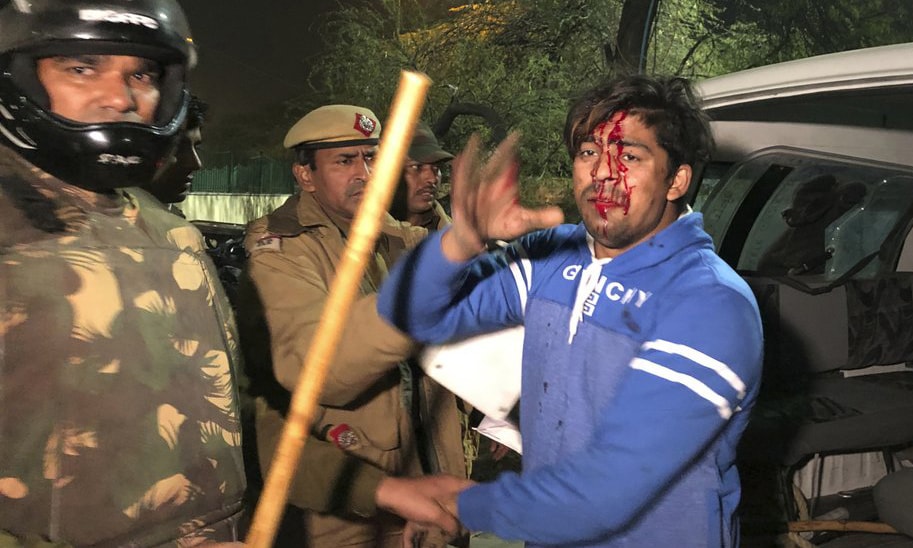 Policemen detain an injured student outside Jamia Millia Islamia university in Delhi during a protest against Citizenship Amendment Act on Sunday. — AP