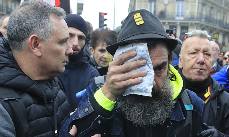 Jerome Rodrigues, one of the leading figures of the yellow vest mouvement holds an ice pack after he was hit in the face by a police officer during a protest against pension reform plans in Paris on Saturday. &mdash; AP