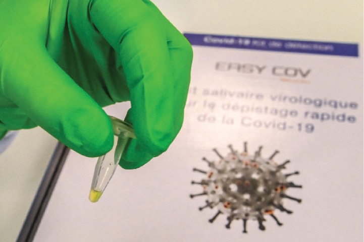 Montpellier (France): A researcher from SkillCell, a biotechnology company, shows a rapid-acting saliva-based test for Covid-19 on Tuesday. The fast-acting saliva test is used by healthcare professionals and works with reagents at a temperature of 65 celsius degrees for 30 minutes after collecting the saliva sample.—AFP