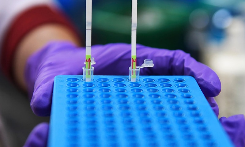 In this file photo taken on October 7, paper-based sample tests for the coronavirus are seen at a laboratory in New Delhi. — AFP