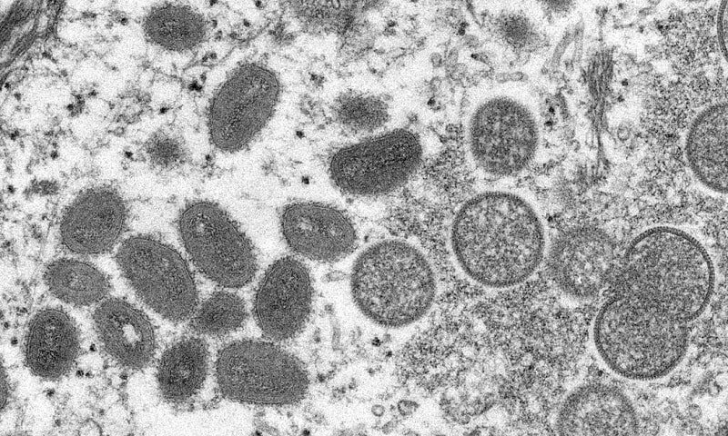 An electron microscopic image shows mature, oval-shaped monkeypox virus particles as well as crescents and spherical particles of immature virions, obtained from a clinical human skin sample associated with the 2003 prairie dog outbreak in this undated image obtained by Reuters on May 18, 2022.