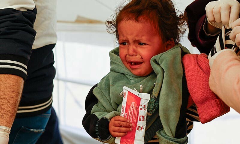 A Palestinian girl is checked for malnutrition at a medical tent set up by MedGlobal in cooperation with Unicef on February 14, 2024. &mdash; Reuters