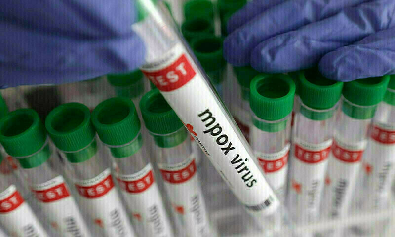 FILE PHOTO: A test tube labelled “Mpox virus positive” is held in this illustration taken August 20, 2024. REUTERS/Dado Ruvic/Illustration/File Photo FILE PHOTO: A test tube labelled “Mpox virus positive” is held in this illustration taken August 20, 2024. REUTERS/Dado Ruvic/Illustration/File Photo