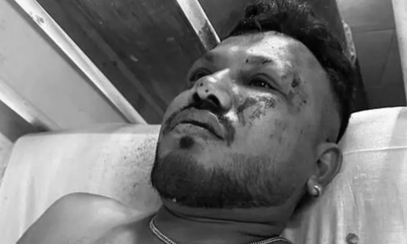 Ramesh Viswashkumar, a passenger who survived the crash of Air India flight AI 171 in Ahmedabad, India on June 12. — via Hindustan Times