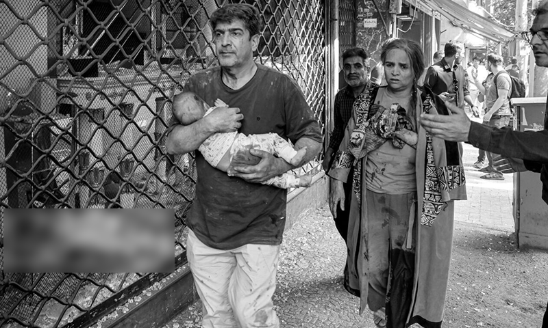 ایک شخص زخمی بچے کو لیکر ہسپتال کی جانب جا رہا ہے
—فوٹو: ارنا ایک شخص زخمی بچے کو لیکر ہسپتال کی جانب جا رہا ہے
—فوٹو: ارنا