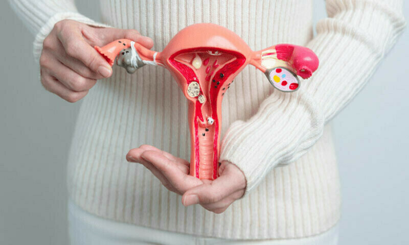 &mdash;فوٹو: فری پک