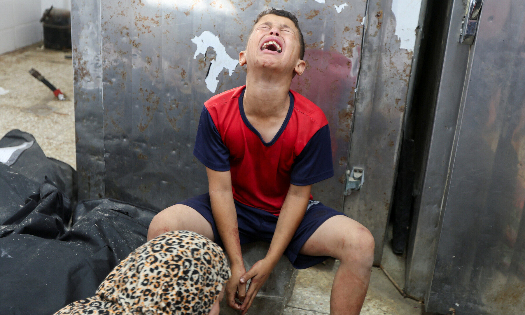  A child reacts as casualties are brought into Al-Aqsa Martyrs Hospital following an Israeli strike, in Deir al-Balah, central Gaza Strip on July 10, 2025. &mdash; Reuters/Ramadan Abed 