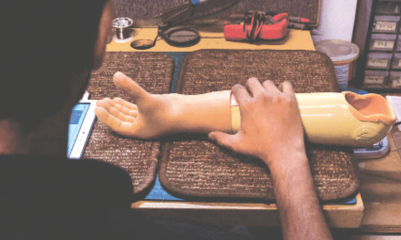 A technician checks a prosthetic limb at Bioniks, which recently started providing prosthetics to Gaza conflict victims.—Reuters